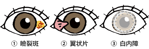 eyes_02.png